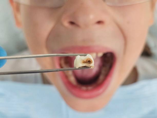 Best Tooth Pain Emergency Relief  in Cokato, MN